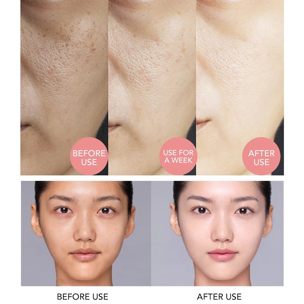 AILKE Face & Body Brightening Serum – Spot Care with Rose & Geranium